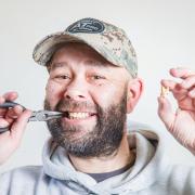 Chris Langston from Oswestry pulled out his own tooth amid a crisis in dentistry.